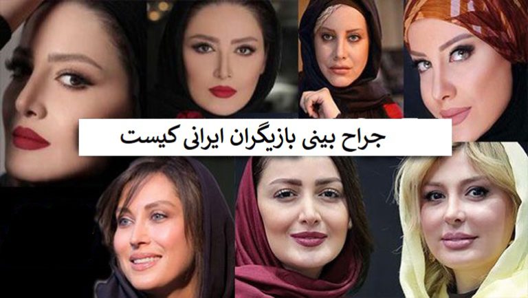 جراح بینی بازیگران ایرانی کیست